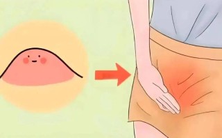 孕期外阴肿胀是正常生理变化还是危险信号？需警惕哪些潜在问题？