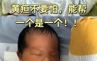 新生儿间接胆红素300μmol/L严重吗？需要立即蓝光治疗吗？