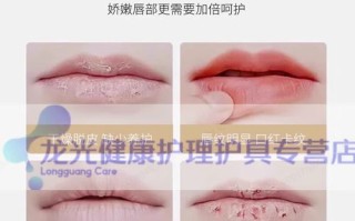 儿童嘴唇干裂用什么药？安全有效的儿童护唇药膏怎么选？