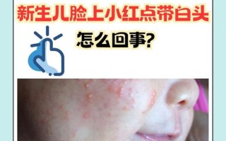 新生儿脸红是正常生理现象还是疾病信号？需关注哪些伴随症状？