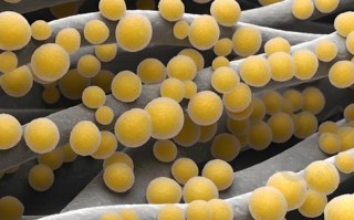 新生儿感染鲍曼不动杆菌的高危因素与防控策略有哪些？