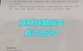 儿童脑白质脱髓鞘病变