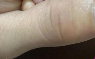 儿童指甲凹凸不平是缺钙还是生病？这些图片背后的健康信号你读懂了吗？