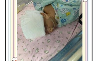 新生儿造瘘袋护理视频，如何正确佩戴、清洁及预防感染？