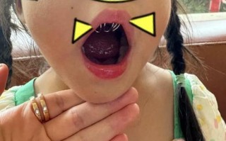 儿童咬指甲的恐怖图片