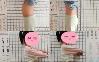 儿童骨盆前倾矫正方法有哪些？不同年龄段矫正方案有差异吗？