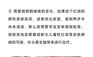 新生儿闻染发剂的味道