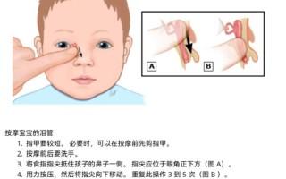 新生儿泪腺炎按摩视频操作手法是否正确？需注意哪些风险事项？