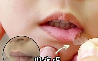 新生儿嘴唇干裂怎么办？日常护理有哪些注意事项？