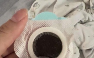 新生儿 胀气 肚脐贴