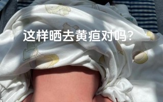 新生儿晒黄疸该晒哪里？晒背部还是晒胸部更有效？