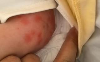 新生儿出现上热症状具体有哪些表现？家长该如何初步判断与应对？