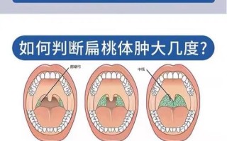 儿童扁桃体肥大，最佳治疗方法是什么？