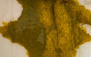 新生儿一个月拉绿粑粑是正常现象还是健康警报？