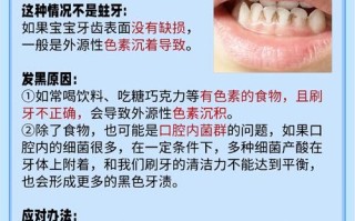 儿童牙龈发黑是正常现象还是疾病信号？需警惕哪些潜在健康风险？