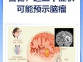 儿童脑瘤的发病诱因有哪些？遗传、环境还是其他未知因素在作祟？