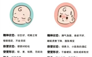 新生儿几天不大便算异常？需不需要担心或就医？