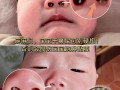 新生儿鼻塞到底能不能自己好？家长需要干预吗？