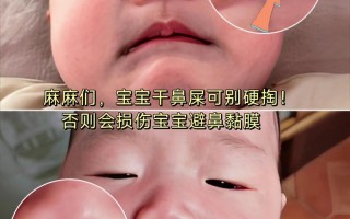 新生儿鼻塞到底能不能自己好？家长需要干预吗？