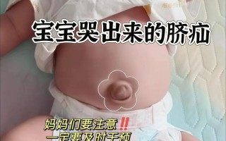 新生儿肚子鼓鼓的是正常现象还是需要警惕的健康问题？