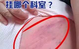 儿童腹腔淋巴结肿大，咋办？