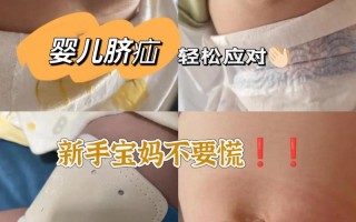 新生儿短肠50cm能存活吗？