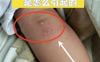 新生儿水土不服会出现哪些症状？家长该如何辨别和应对？