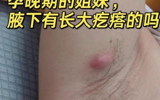 孕期腋下出现硬块且按压疼痛，是孕期激素变化还是乳腺病变的信号？