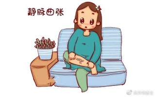 孕期外阴静脉曲张真的可怕吗？会对母婴造成哪些影响，又该如何科学应对？