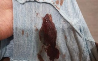 孕期出血伴随肚子咕噜响，是宝宝求救信号还是正常反应？