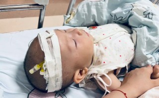 新生儿重症肺炎并发肺出血的致命风险与救治难点究竟在哪里？