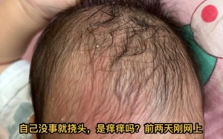 如何正确安全去除新生儿头上的顽固胎垢？