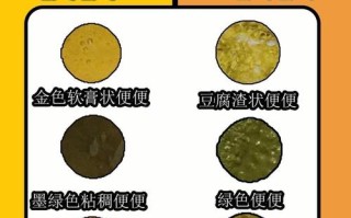 新生儿混合喂养大便次数多少正常？