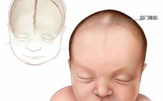 新生儿颅内囊肿一定会被吸收吗？吸收过程受哪些因素影响？