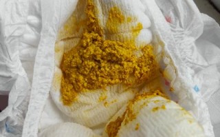 新生儿20天一天拉几次算正常？大便次数异常怎么办？