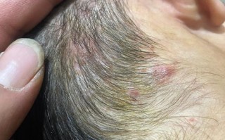 7岁孩子脑瘤早期症状有哪些？家长需警惕哪些异常信号？