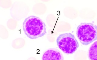 新生儿白细胞红细胞低到底是怎么回事？需要紧急处理吗？