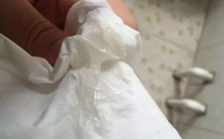 孕期有豆腐渣样分泌物