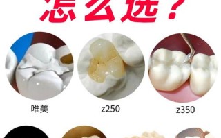 儿童补牙材料怎么选？哪种安全又耐用，家长纠结时该听谁的？