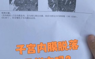孕期子宫内膜会脱落吗？孕期子宫内膜脱落是否正常？