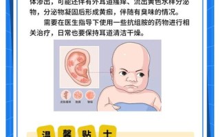 新生儿外耳道湿疹反复发作，究竟是什么原因在作祟？