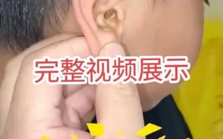 儿童耵聍栓塞怎么取出？在家能操作吗？需要去医院吗？