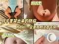 新生儿脐疝一般多久能自行愈合？家长日常护理要注意哪些事项？