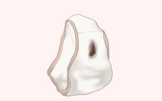 新生儿吐褐色的分泌物