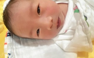 新生儿一个月黄疸12mg/dl还没退怎么办？需要治疗吗？