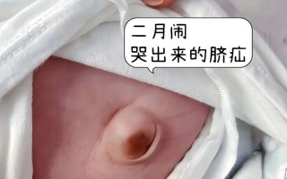 新生儿肚脐突出是正常现象还是异常信号？需警惕哪些潜在风险？