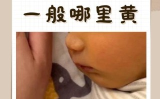 新生儿黄疸不能母乳吗