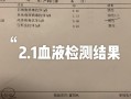 孕期单纯疱疹病毒IgM阳性怎么办？