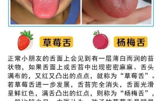 儿童草莓舌的出现是哪些疾病在作祟？需要家长警惕哪些潜在健康问题？