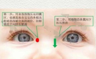新生儿泪囊炎按摩手法具体该怎么做？力度和频率有讲究吗？